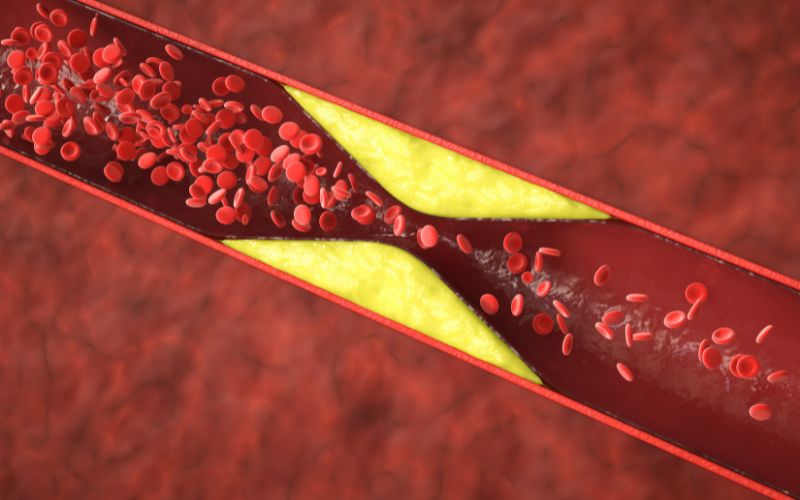 Giảm cholesterol